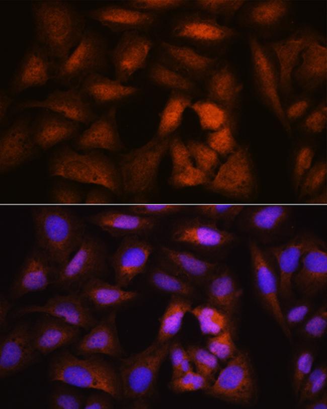 NCAPH Antibody in Immunocytochemistry (ICC/IF)