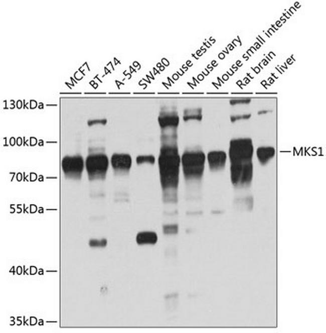 MKS1 Antibody in Western Blot (WB)