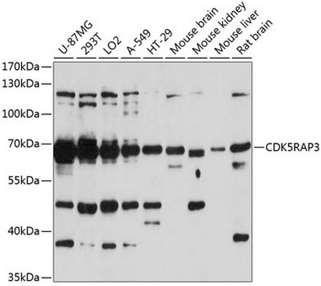 CDK5RAP3 Antibody in Western Blot (WB)