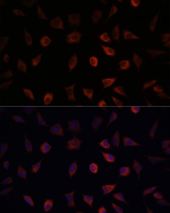 FABP1 Antibody in Immunocytochemistry (ICC/IF)