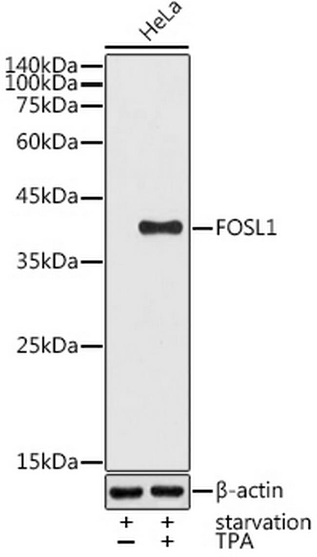 Fra1 Antibody in Western Blot (WB)