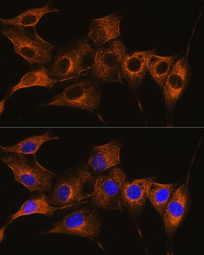 C7 Antibody in Immunocytochemistry (ICC/IF)