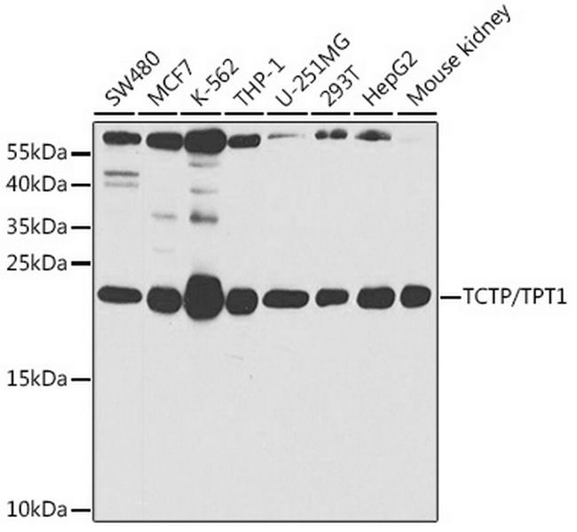 TPT1 Antibody in Western Blot (WB)