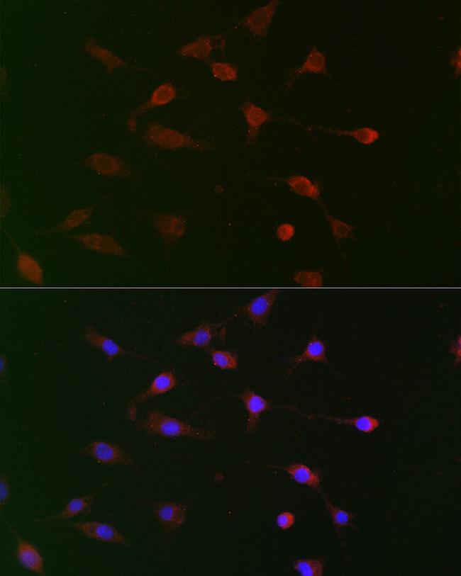 CDC34 Antibody in Immunocytochemistry (ICC/IF)