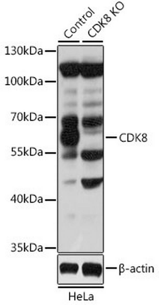 CDK8 Antibody in Western Blot (WB)