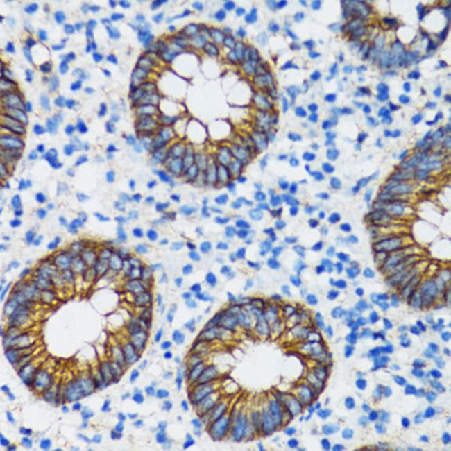 alpha Catenin Antibody in Immunohistochemistry (Paraffin) (IHC (P))