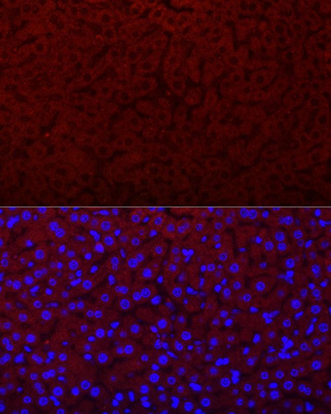 Epo Antibody in Immunocytochemistry (ICC/IF)