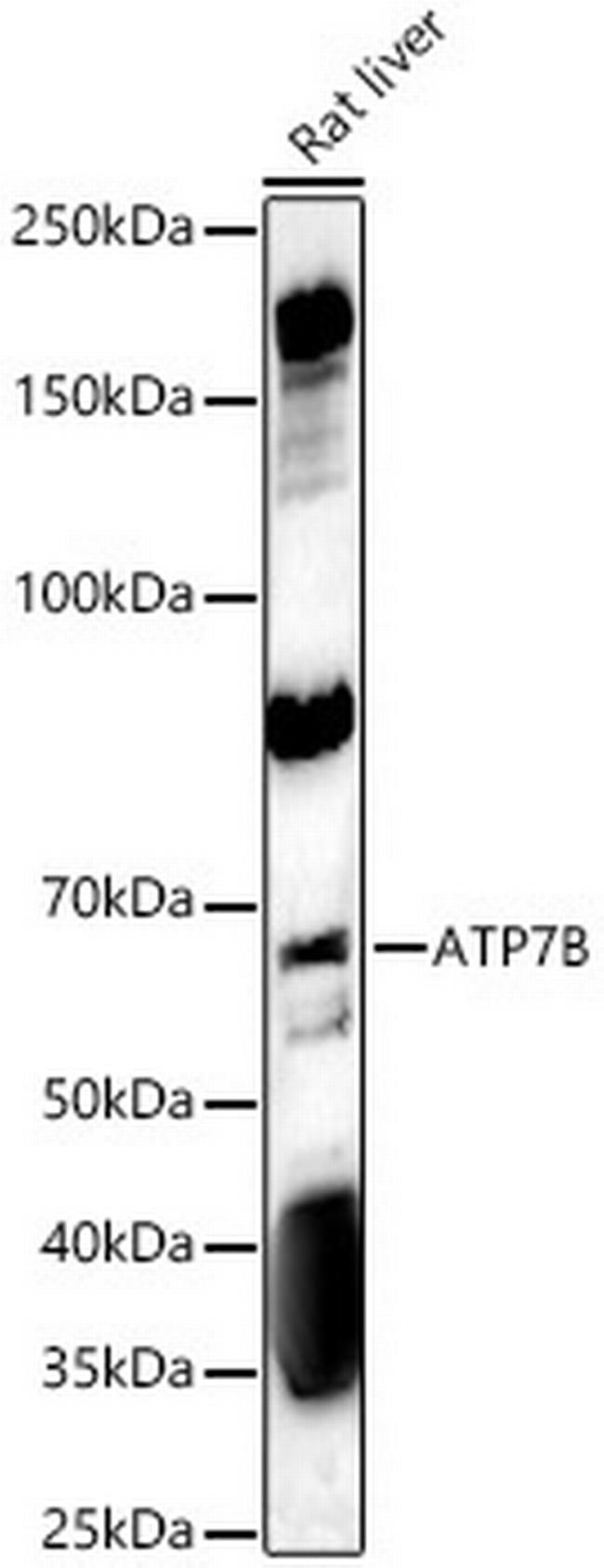 ATP7B Antibody in Western Blot (WB)