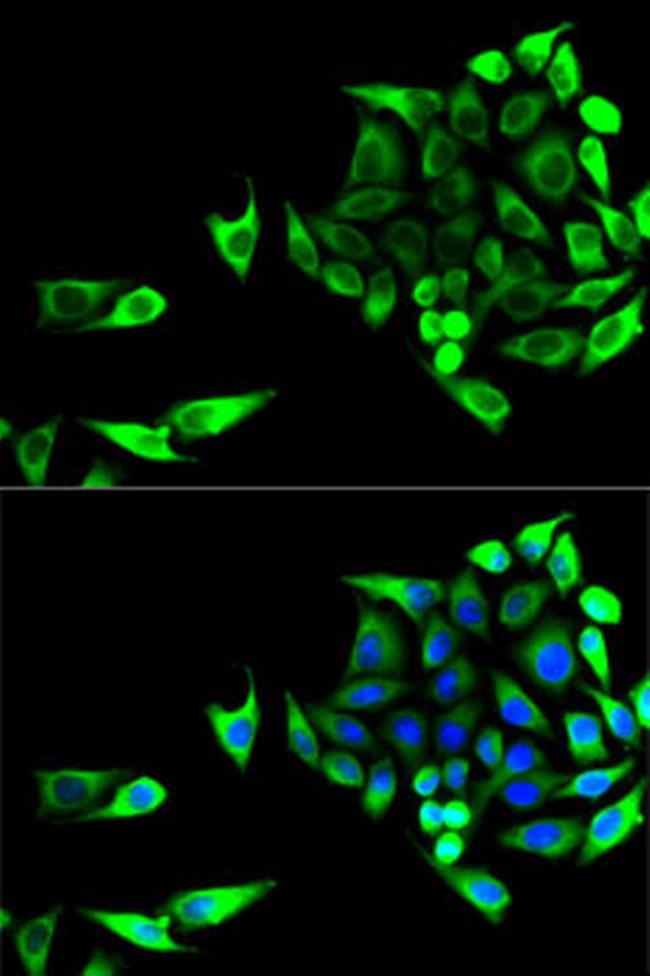 GOT1 Antibody in Immunocytochemistry (ICC/IF)