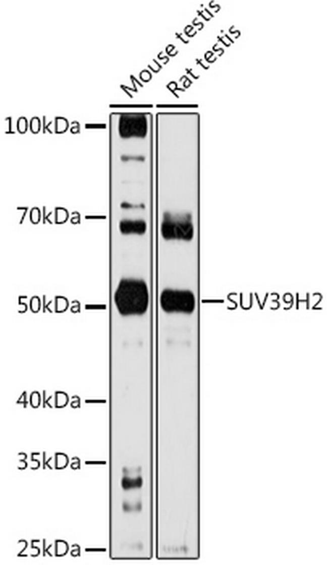 SUV39H2 Antibody in Western Blot (WB)