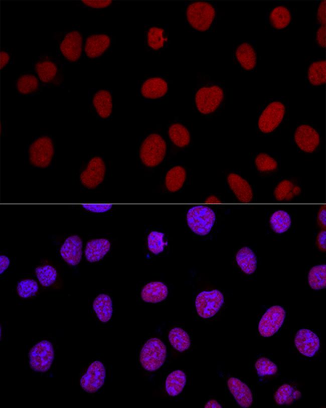 Ku80 Antibody in Immunocytochemistry (ICC/IF)