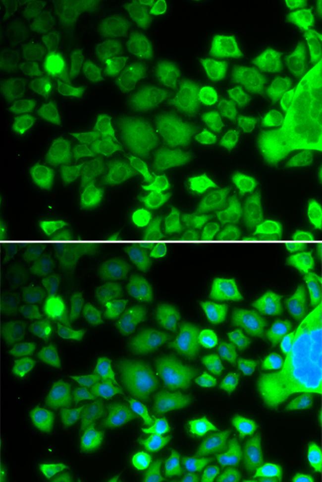 RPS10 Antibody in Immunocytochemistry (ICC/IF)