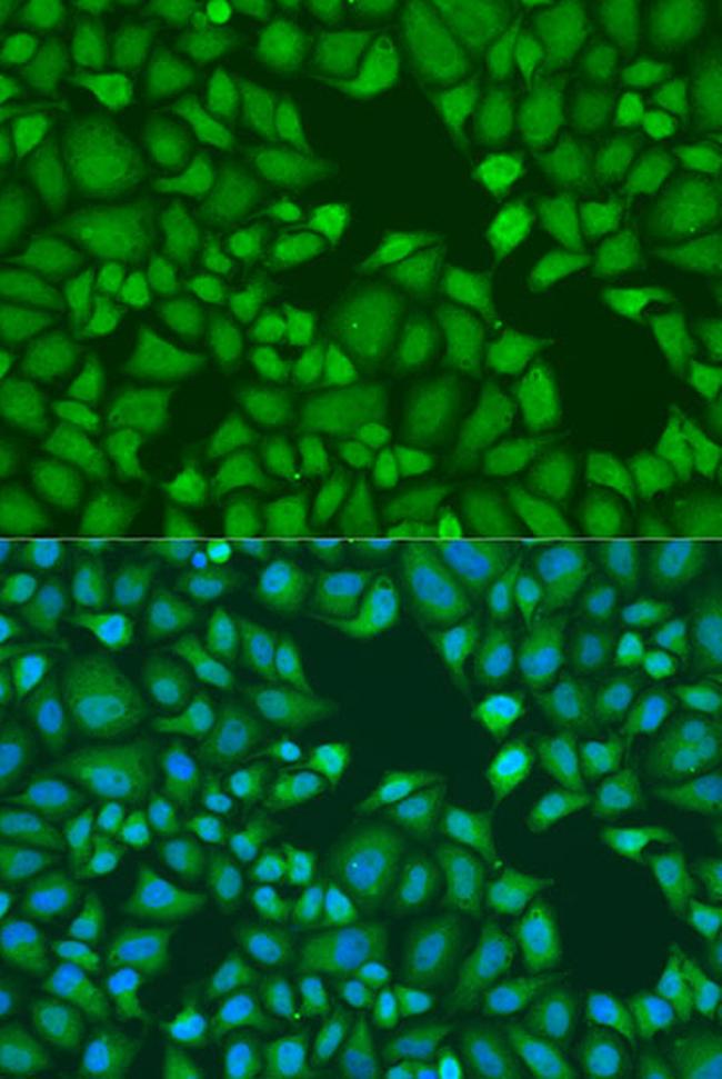 TNRC6A Antibody in Immunocytochemistry (ICC/IF)