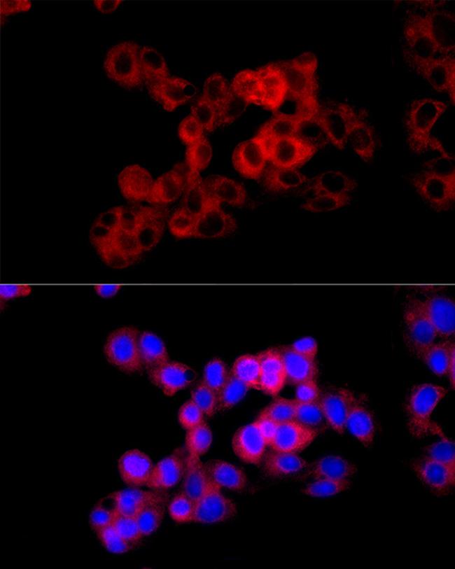 CTH Antibody in Immunocytochemistry (ICC/IF)