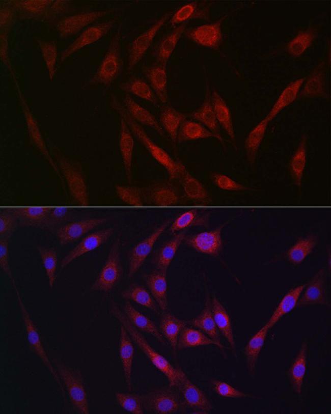 FGF23 Antibody in Immunocytochemistry (ICC/IF)