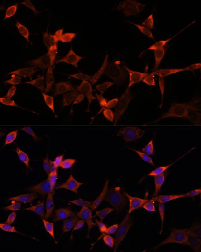 PRAS40 Antibody in Immunocytochemistry (ICC/IF)