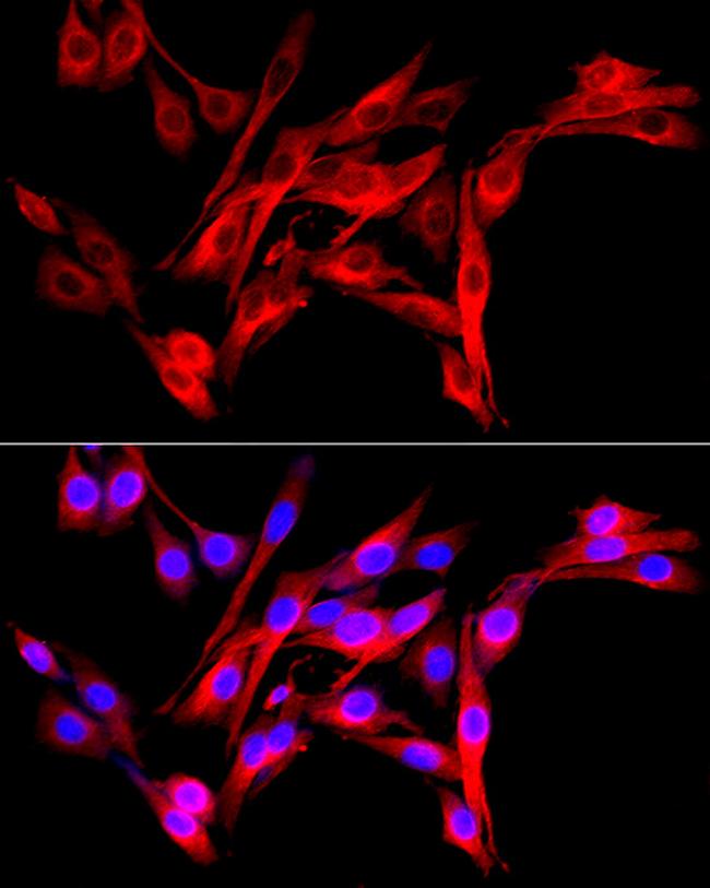 FAP Antibody in Immunocytochemistry (ICC/IF)