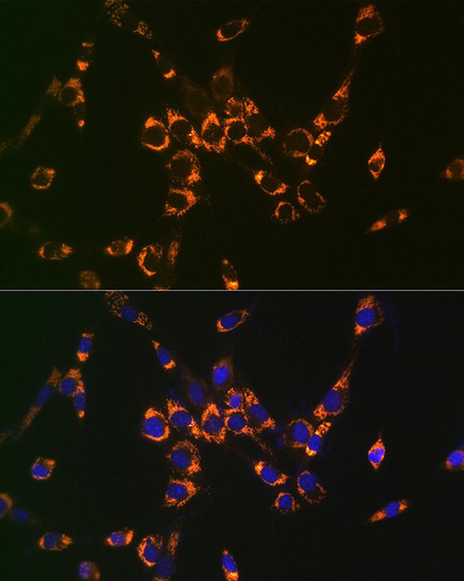 ASL Antibody in Immunocytochemistry (ICC/IF)