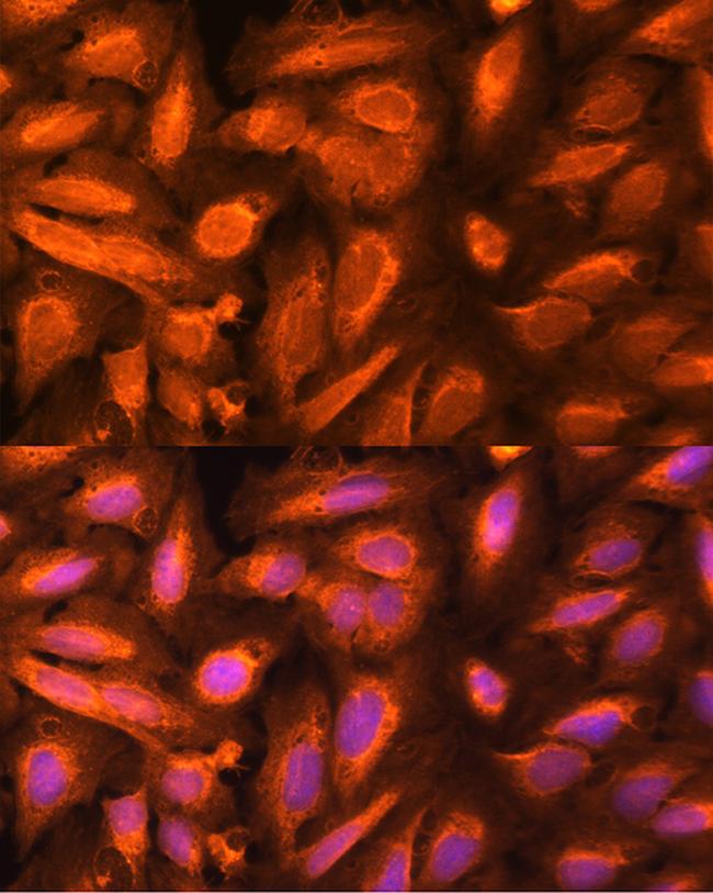 DTYMK Antibody in Immunocytochemistry (ICC/IF)