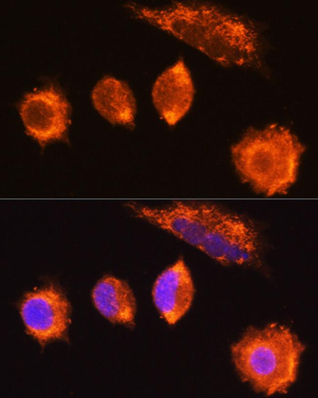 MGAT1 Antibody in Immunocytochemistry (ICC/IF)