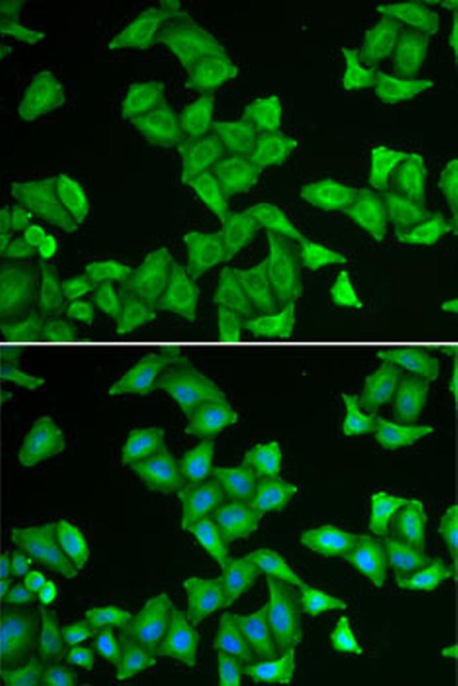 COX5A Antibody in Immunocytochemistry (ICC/IF)