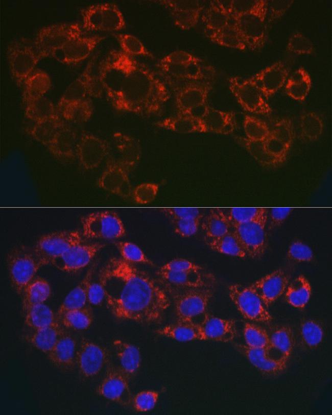 GPLD1 Antibody in Immunocytochemistry (ICC/IF)