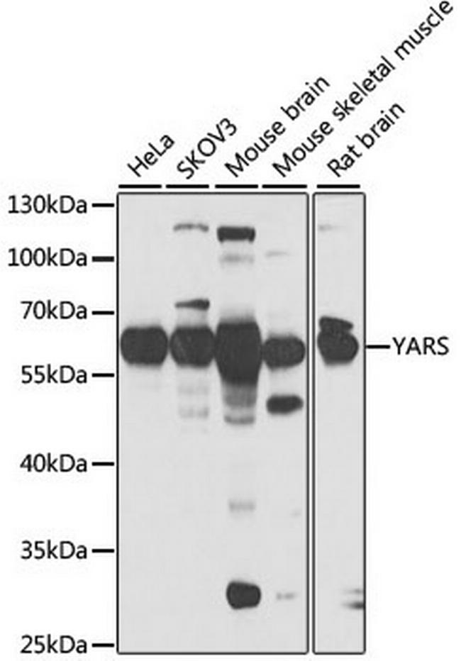 YARS Antibody in Western Blot (WB)