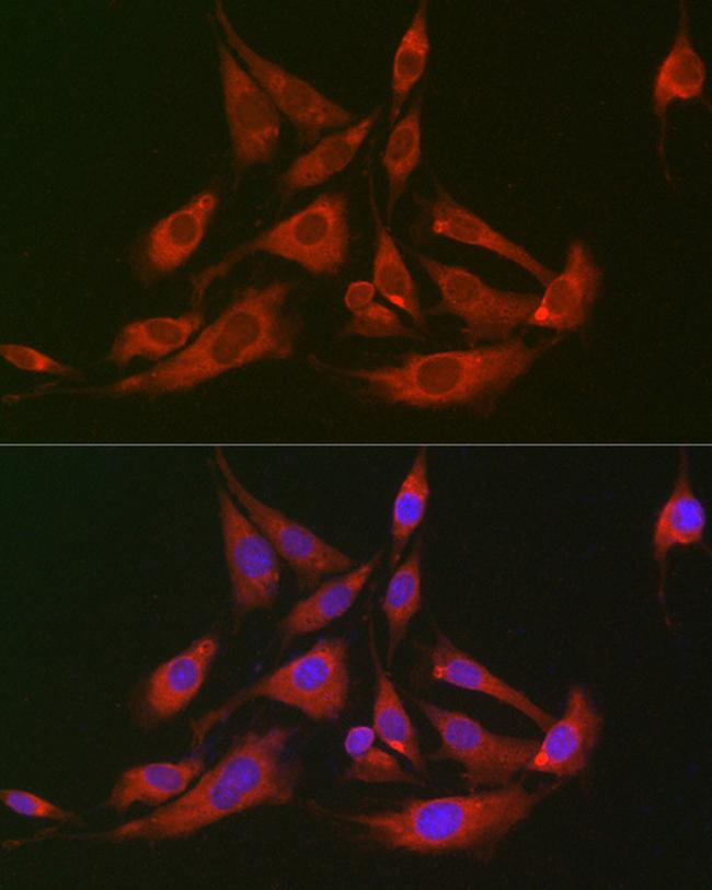 GOT2 Antibody in Immunocytochemistry (ICC/IF)