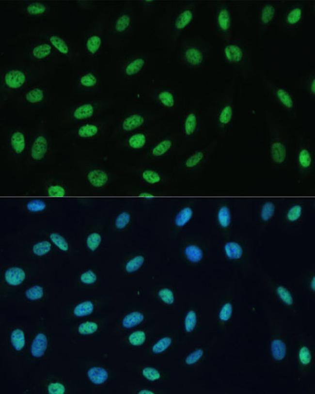 hnRNP M Antibody in Immunocytochemistry (ICC/IF)