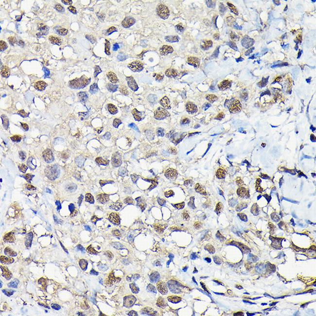 PFKFB3 Antibody in Immunohistochemistry (Paraffin) (IHC (P))