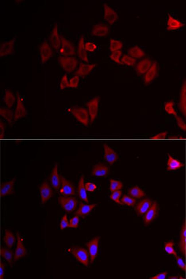 MEK5 Antibody in Immunocytochemistry (ICC/IF)