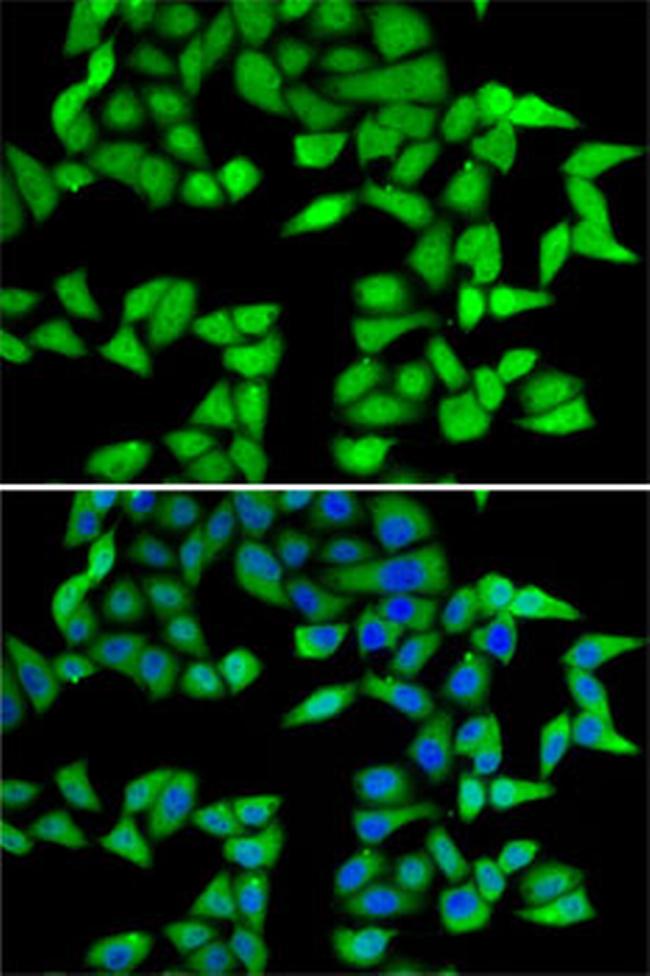 RBBP5 Antibody in Immunocytochemistry (ICC/IF)