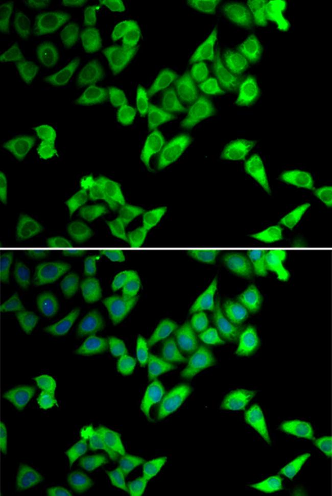 TRIP10 Antibody in Immunocytochemistry (ICC/IF)