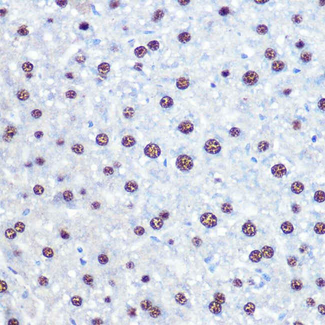 APIP Antibody in Immunohistochemistry (Paraffin) (IHC (P))