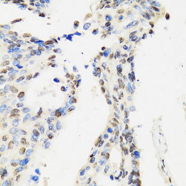 DBC1 Antibody in Immunohistochemistry (Paraffin) (IHC (P))