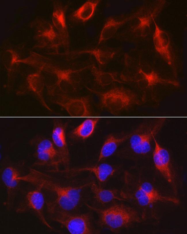 METTL7B Antibody in Immunocytochemistry (ICC/IF)