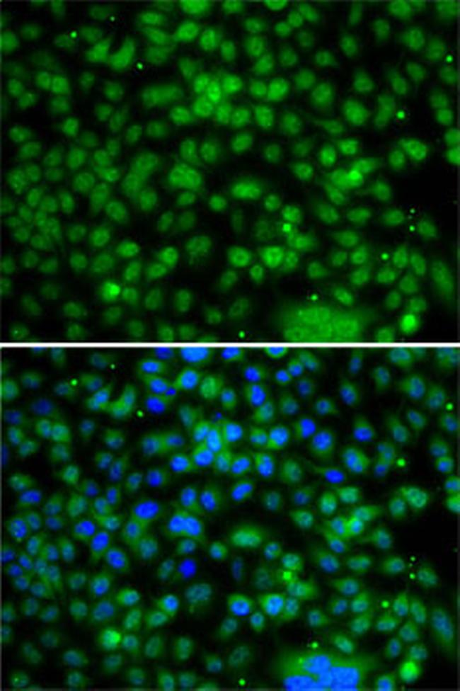 PHYHD1 Antibody in Immunocytochemistry (ICC/IF)