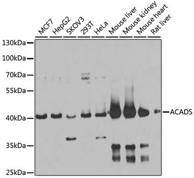 ACADS Antibody in Western Blot (WB)