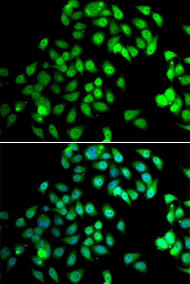 NCBP2 Antibody in Immunocytochemistry (ICC/IF)