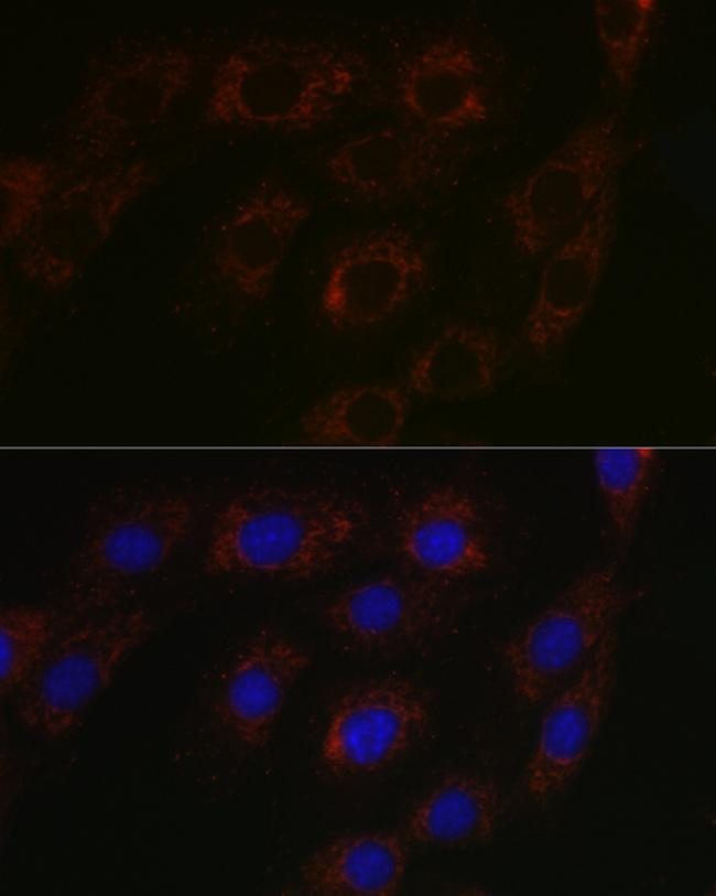 BCAT2 Antibody in Immunocytochemistry (ICC/IF)