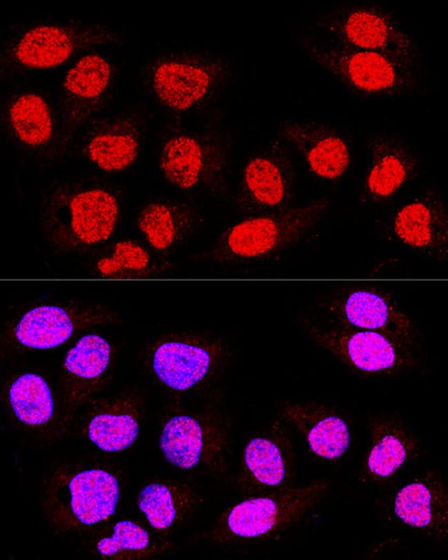 TEF5 Antibody in Immunocytochemistry (ICC/IF)