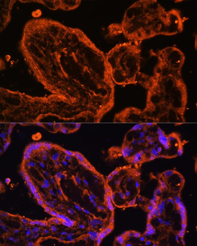 LDB3 Antibody in Immunocytochemistry (ICC/IF)