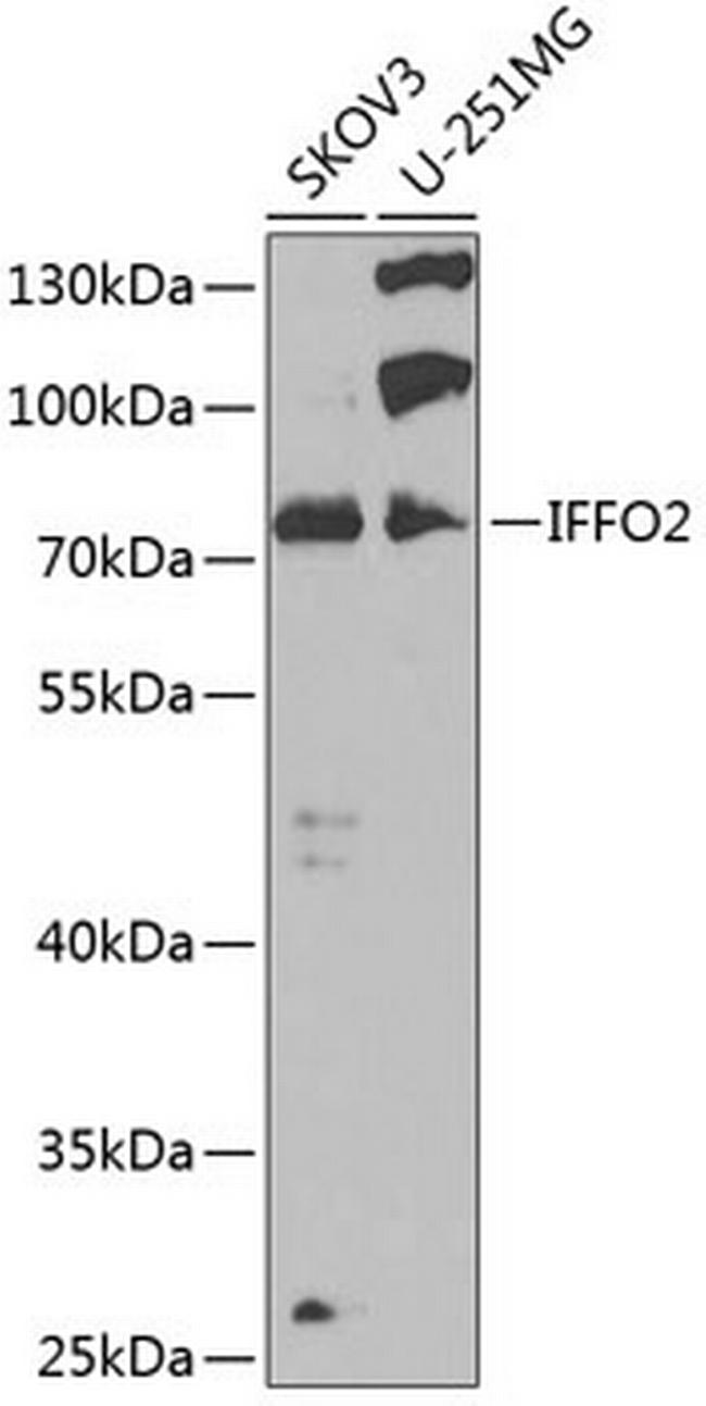 IFFO2 Antibody in Western Blot (WB)