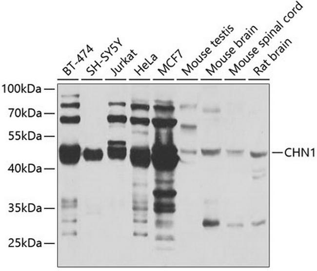 CHN1 Antibody in Western Blot (WB)