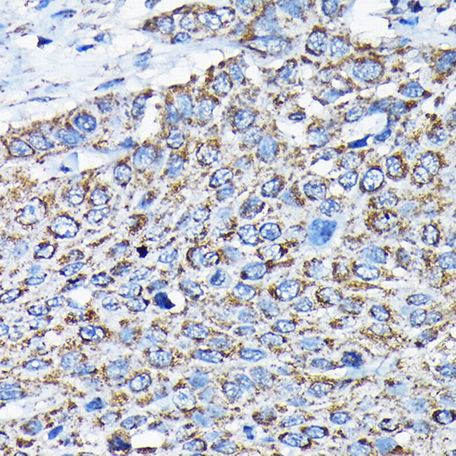 ETFA Antibody in Immunohistochemistry (Paraffin) (IHC (P))