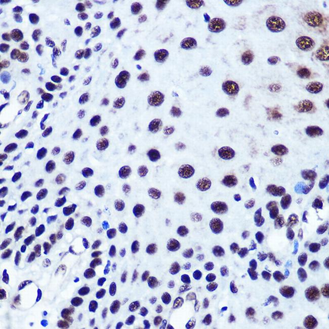 SRF Antibody in Immunohistochemistry (Paraffin) (IHC (P))