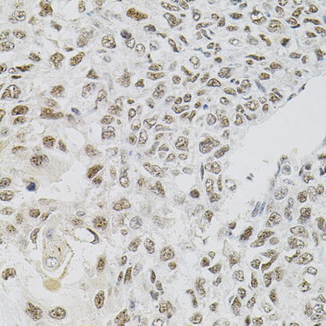 FAF1 Antibody in Immunohistochemistry (Paraffin) (IHC (P))