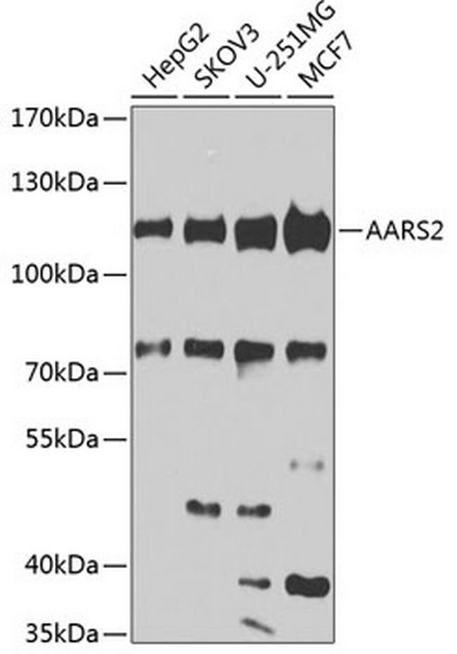 AARS2 Antibody in Western Blot (WB)