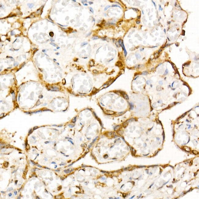 STX7 Antibody in Immunohistochemistry (Paraffin) (IHC (P))