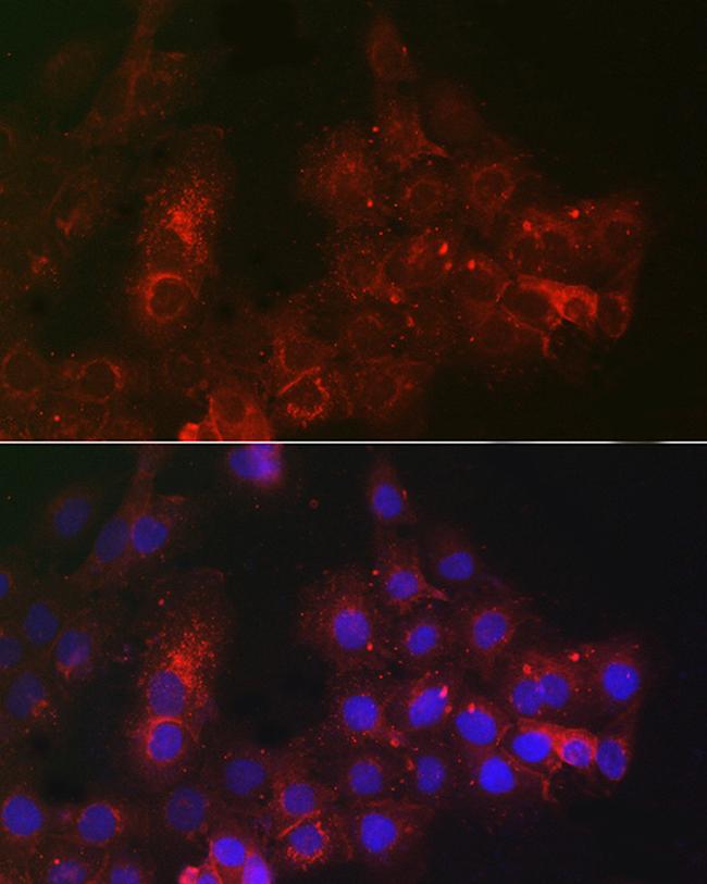 TROP2 Antibody in Immunocytochemistry (ICC/IF)